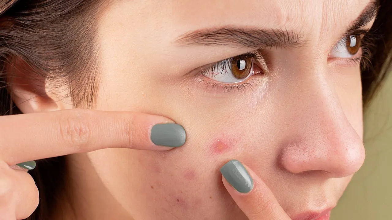 how to get rid of pimples overnight at home